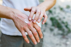 How To Find Relief Through Targeted Psoriasis Treatment How To Find Relief Through Targeted Psoriasis Treatment